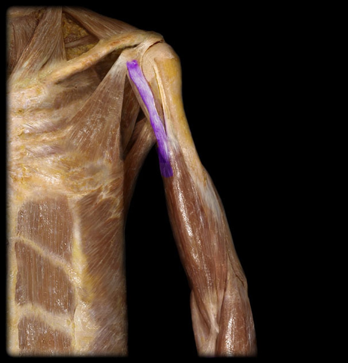 <p>Origin: coracoid process of scapula</p><p>Insertion: radial tuberosity, deep forearm fascia</p>