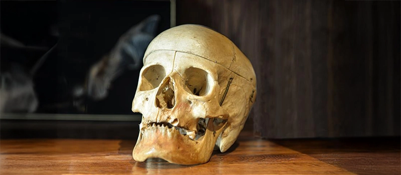 <p>A collection of bones which encase the brain and give form to the head and face</p>