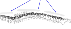 <p>What muscle, part of the transversospinalis system, is shown?</p>