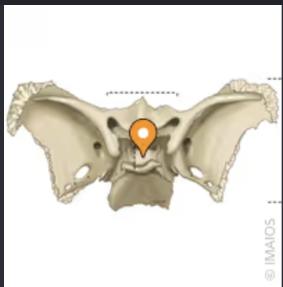 <p>What is this structure? &nbsp;</p>