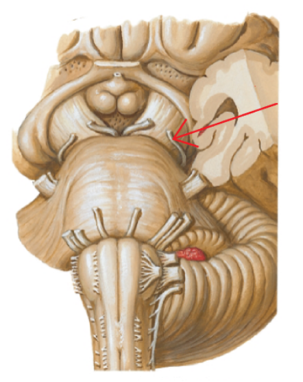 <p>Cranial nerve IV</p>