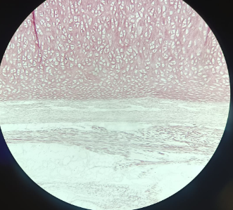 <p>Epiglottis - Orcein</p><ul><li><p>located at the end of mouth cavity</p></li><li><p>2 different types of epithelium:</p><ul><li><p>Facing the mouth: stratified squamous non-keratinized epithelium</p></li><li><p>Facing the larynx: pseudo stratified columnar ciliated epithelium </p></li></ul></li><li><p>Orcein - stains elastic structures of elastic cartilage</p></li><li><p>has 2 perichondrium </p></li><li><p>Deep zone of cartilage - middle has a lot of cells, very narrow space between cells stained with orcein</p></li></ul><p></p>