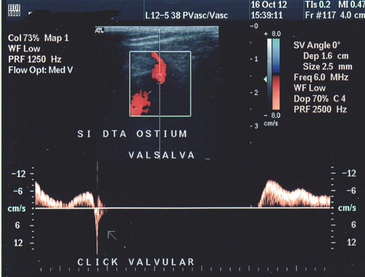 <p>normal or abn?</p>