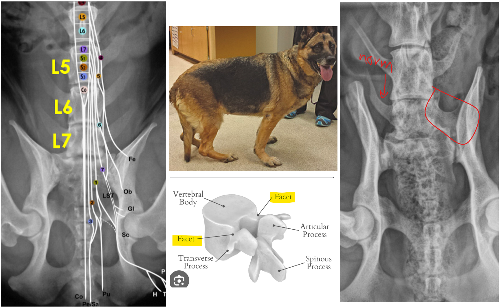 <p>1: mild gait changes, prop deficits in pelvic limb, dec flexor reflex in pelvlic limb, mild to mod pain in LS region</p><p>.</p><p>2: gold standard = MRI bc can see ligaments, IVD, nerve roots, etc.</p><p>BUT can rule out other ddx &amp; dx w/ spinal rads by looking for: narrow IVD space, sclerotic endplates, sacral osteochondrosis, spondylosis deformans, &amp; transverse process of L7 starts to fuse to ilium (AKA “transitional vertebrae”)</p><p>.</p><p><em>note: this dz is very sim to cervical spondylomyopathy but in LS region</em></p>