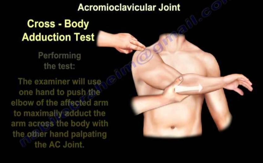 <p>Lift the arm straight out in front, then pull it across the chest toward the other shoulder. Pain on top of the shoulder is positive.</p>