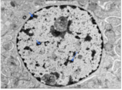 <p>Identify the following structures in electron micrograph</p>