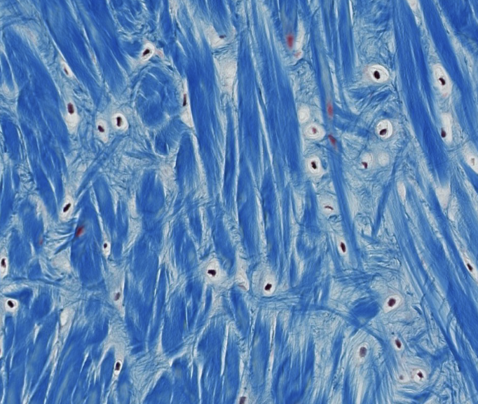 <p>fibrocartilage</p>