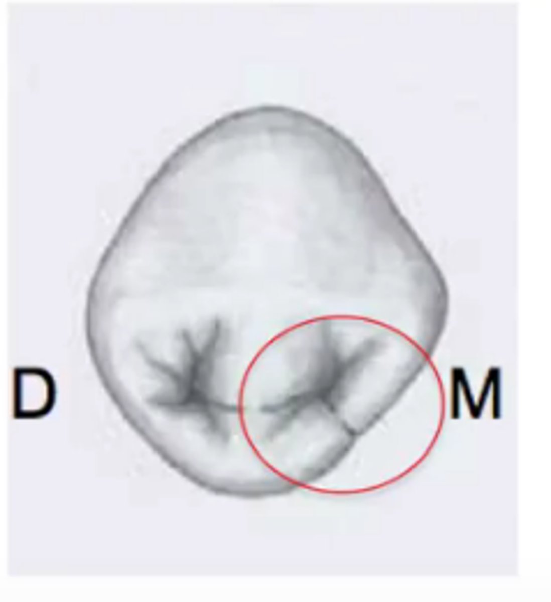 <p>developmental line separating parts of a tooth</p>