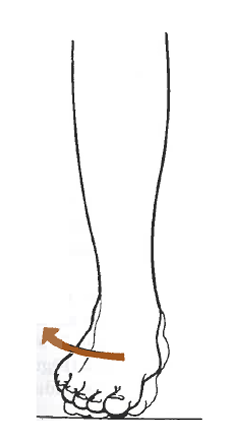 <p>What is this motion </p>