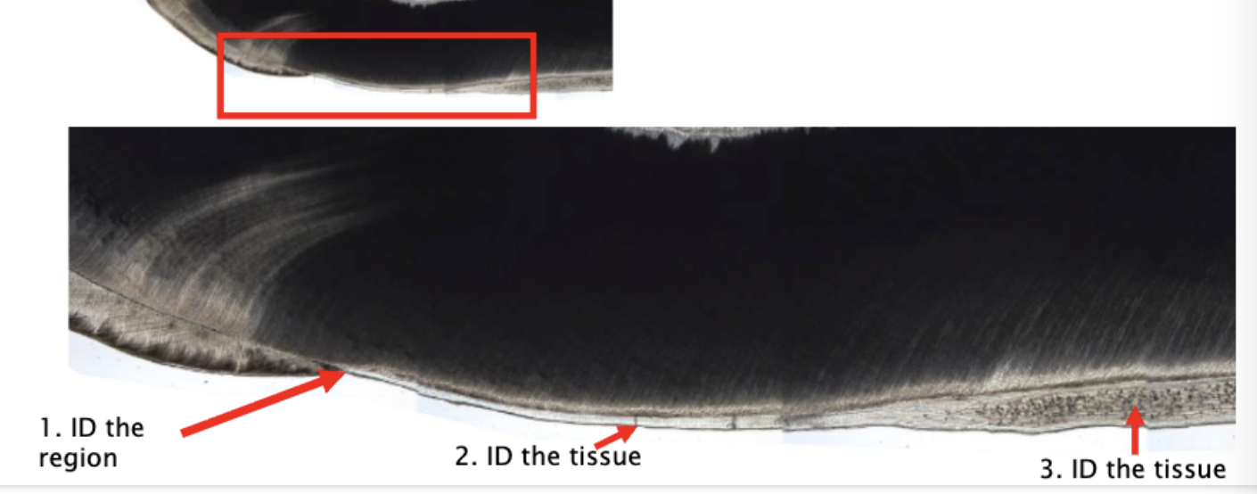 <ol start="2"><li><p>ID the tissue </p></li></ol><p></p>