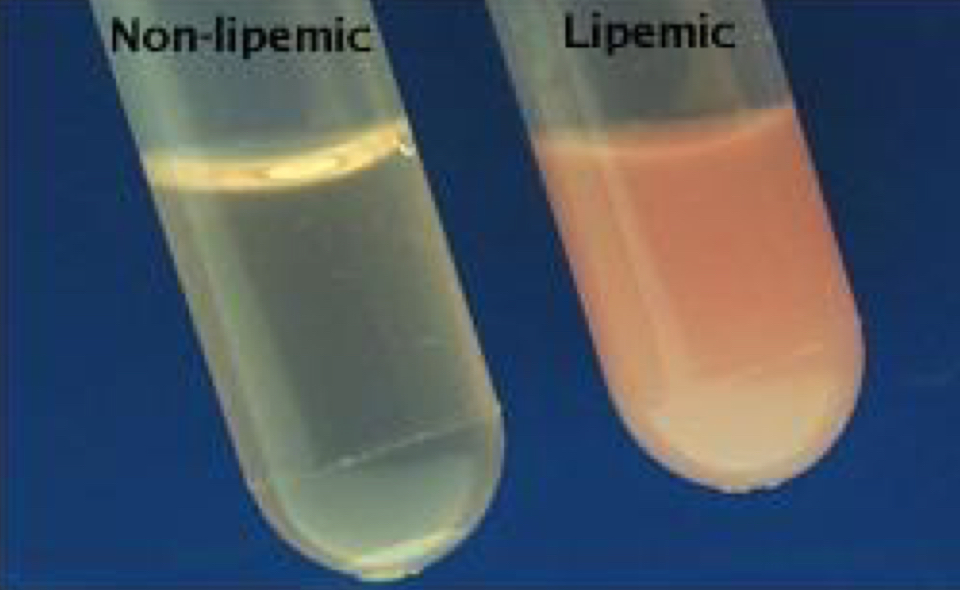 <ul><li><p>The presence of excessive fat particles (lipids), particularly triglycerides, in the blood, causing <strong><u>plasma or serum</u></strong> to appear milky, cloudy, or opaque</p></li><li><p>Lipemia can interfere with the accurate measurement of B.W analytes</p><ul><li><p>Hgb, MCHC, Total Protein, Platelet, bilirubin, electrolytes, etc.</p></li></ul></li></ul><p></p>