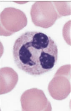 <p>How to identify neutrophils?</p>