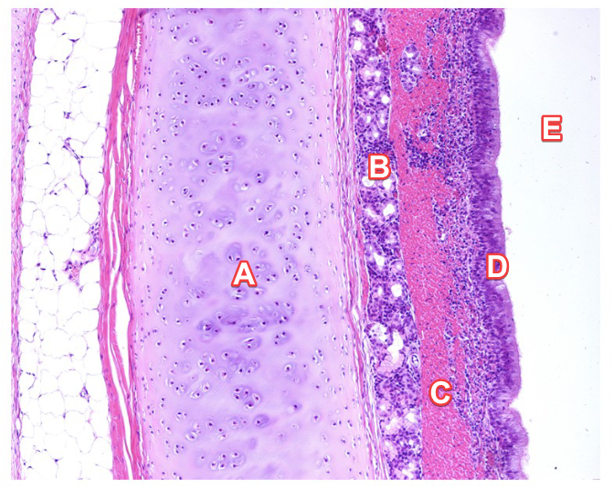 <p>In the histology slide of the trachea, <strong>Label A</strong> is the…</p>