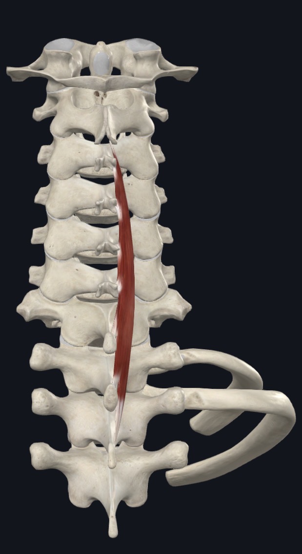 <p>Spinalis Cervicis <strong>Origin</strong></p>