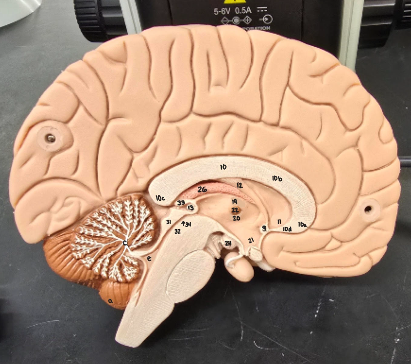 <p>Name Major Region/Major Part of the Brain (All The Lobes)</p>