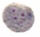 <p>What Amebae is this? Is this the trophozoite or cyst form?</p>