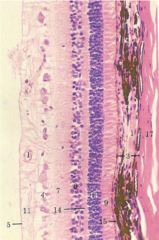 <p>retinal tissue layers, 3</p>