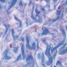 <p>what kind of tissue is this</p>