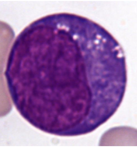<p>Which type of white blood cell is shown in this picture? What are the characteristics of this type of white blood cell?</p>