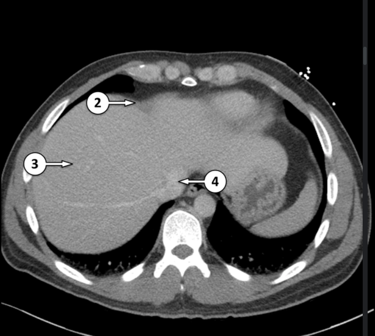 <p>Label the CT abdomen </p>