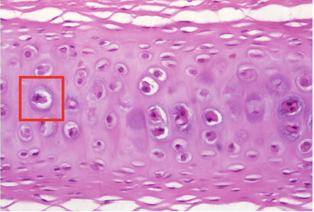 <p>Identify the CELL seen in the red box</p>