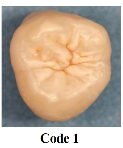 <p>First visual changes in enamel translucency visible only after prolonged drying</p>