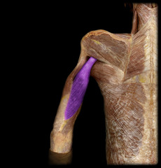 <p>Identify the structure</p>