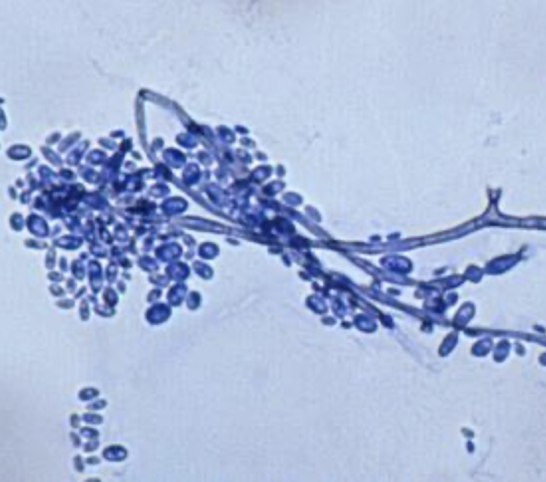 term image