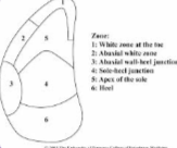 <p>Which zone is most commonly affected by white line disease in cattle?</p>