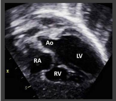 <p>what APEX AND THORACIC POSITION is this</p>