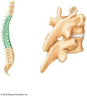 <p>What is white space separating the bone?</p>
