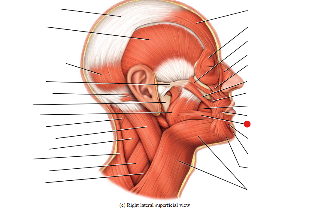 <p>Identify the structure pinned</p>