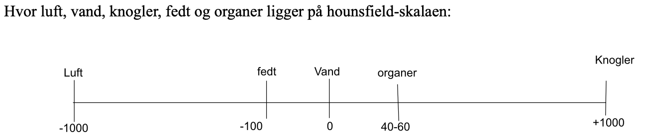 <p><span style="background-color: transparent;">Hounsfield</span></p>