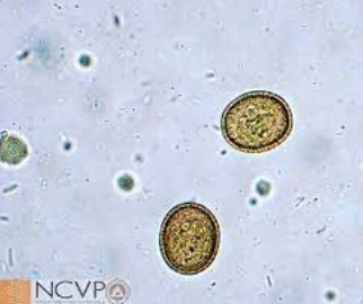 <p>what is it (Tapeworms/Cestodes)</p>