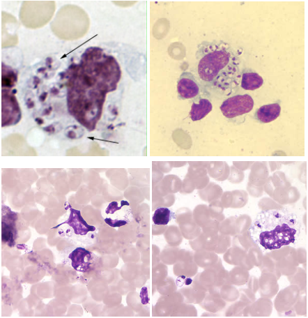 <p>Leishmania spp., amastigotes</p><p>Disease: <u>Leishmaniasis</u></p><p>Vector: <u>Sandfly</u></p><p>Infective stage: <u>Promastigote </u></p><p>Diagnostic stage: <u>Amastigote</u></p><p>Treatment: Amphotericin B</p>