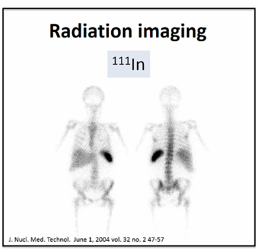 <p>Radiation Imaging</p>