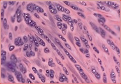 <p>tough due to its thick bundles of collagen fibers dispersed through its matrix</p><p>- found in menisci in the knee joint and the intervertebral discs</p>