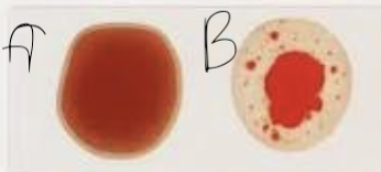 <p>what blood type is this? </p>