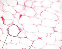 <p>What kind of tissue is being shown in the slide</p>