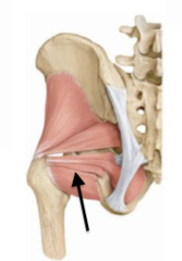 <p>Origin Ischium, sacrum, obturator foramen</p><p>Insertion:femur</p><p>Action: rotate hip</p><p>deep to gluteal</p>