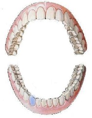 <p>mandibular right canine</p>