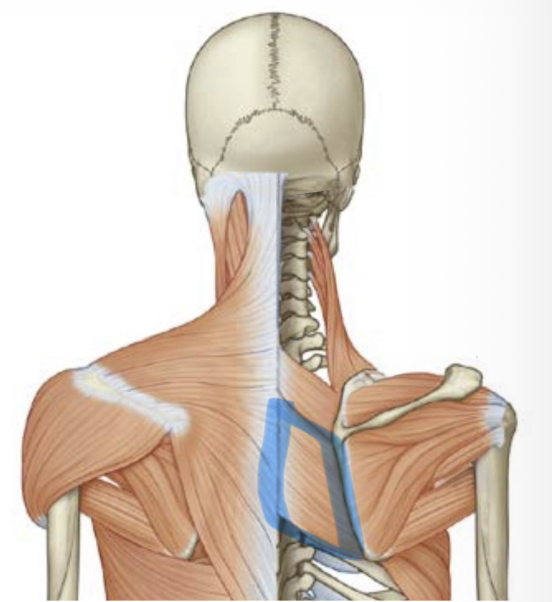 term image
