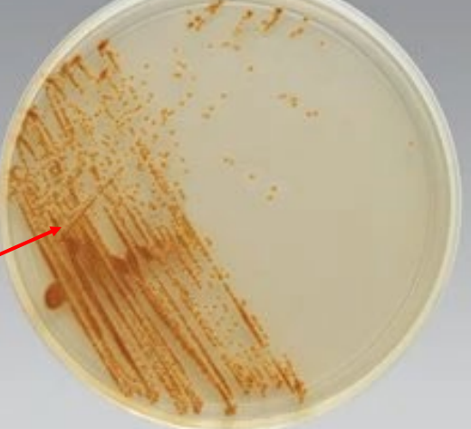 <p>test and result</p>