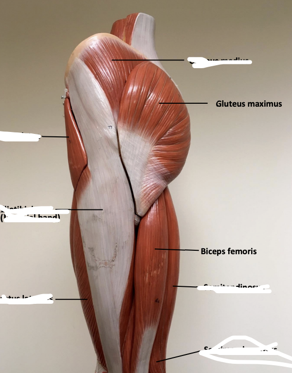 <p><strong>Biceps femoris</strong></p>