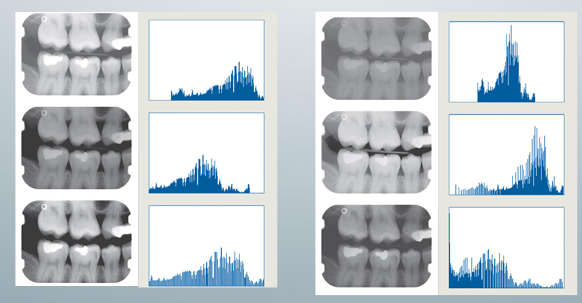<p>-digital radiographs do not always use the full range of available gray values effectively</p><p>-can be relatively dark or light, showing too much contrast in certain areas or not enough</p><p>-digital imaging software commonly includes tools for the adjustment of brightness and contrast</p>