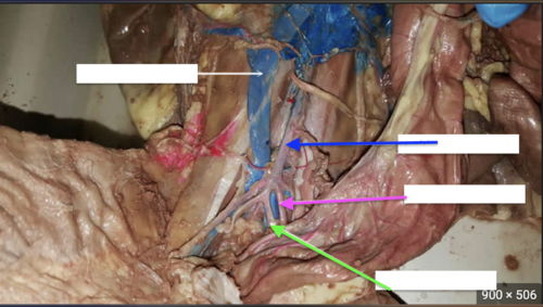 <p>blue arrow (artery)</p>
