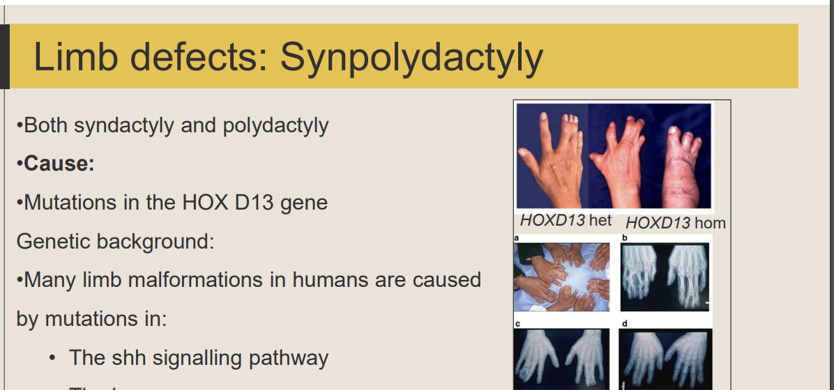 <p><strong>A:</strong> SHH signalling pathway and HOX genes</p>