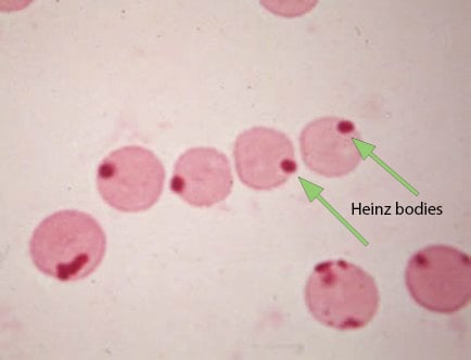 <p>decreases RBC lifespan and deform cell</p>