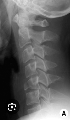 <p>what is the diagnosis?</p>