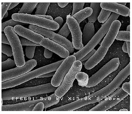 <ul><li><p>Gram-negative</p></li><li><p>Rod-shaped (bacillus)</p></li><li><p>Facultative anaerobe</p></li><li><p>Non-sporulating</p></li><li><p>Member of enteric bacteria (order Enterobacteriales)</p></li></ul><p></p>